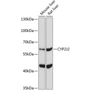Western blot analysis of extracts of various cell lines using CYP2J2 Antibody (1/1000 dilution).