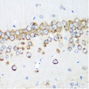 Immunohistochemistry of paraffin-embedded Rat brain using MTDH Antibody (1/200 dilution, 40x lens).