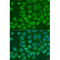 Metadherin (MTDH) Antibody