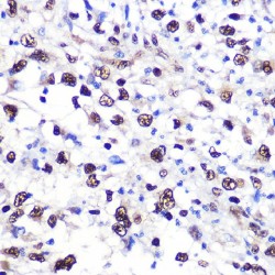 Nucleolin (NCL) Antibody