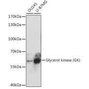 Western blot analysis of extracts of various cell lines using Glycerol kinase Antibody (1/3000 dilution).