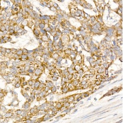 Glycerol Kinase (GK) Antibody