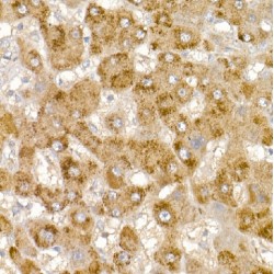 Glycerol Kinase (GK) Antibody