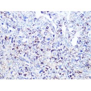 abx006824