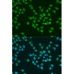Krueppel-Like Factor 4 (KLF4) Antibody