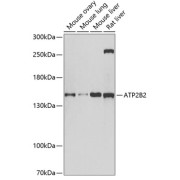 Western blot analysis of extracts of various cell lines using ATP2B2 Antibody (1/1000 dilution).
