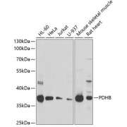 Western blot analysis of extracts of various cell lines using PDHB Antibody (1/1000 dilution).