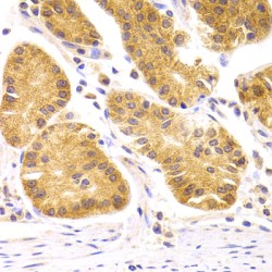 Protein SCO2 Homolog, Mitochondrial (SCO2) Antibody