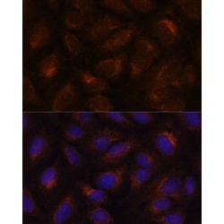 Anterior Gradient Protein 2 Homolog (AGR2) Antibody