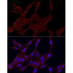 Serine/Threonine-Protein Kinase PLK2 (PLK2) Antibody