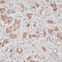 Testin (TES) Antibody