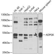 Western blot analysis of extracts of various cell lines using ADPGK Antibody (1/1000 dilution).