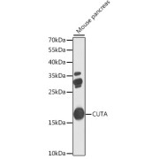 Western blot analysis of extracts of mouse pancreas using CUTA Antibody (1/1000 dilution).