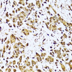 X-Ray Repair Cross Complementing 6 (XRCC6) Antibody