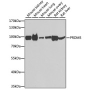 Western blot analysis of extracts of various cell lines using PRDM5 Antibody (1/1000 dilution).