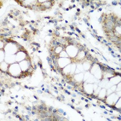 N-Alpha-Acetyltransferase 60 (NAA60) Antibody