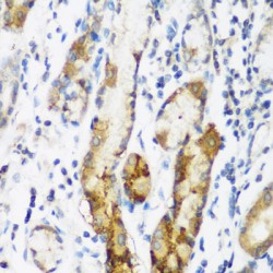 N-Alpha-Acetyltransferase 60 (NAA60) Antibody