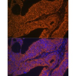RAB5B, Member RAS Oncogene Family (RAB5B) Antibody