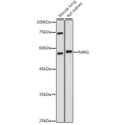 Western blot analysis of extracts of various cell lines using RARG Antibody (1/1000 dilution).