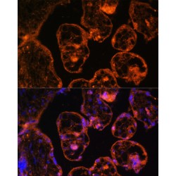 LIM Domain Binding Protein 3 (LDB3) Antibody
