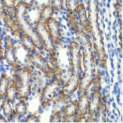 Immunohistochemistry of paraffin-embedded rat kidney using ZFAND3 Antibody (1/100 dilution, 40x lens). Microwave antigen retrieval was performed in 10 mM PBS buffer pH 7.2 before commencing with IHC staining protocol.
