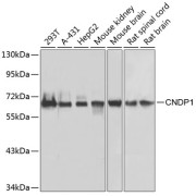 Western blot analysis of extracts of various cell lines using CNDP1 Antibody (1/1000 dilution).