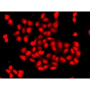 Immunofluorescence analysis of A549 cells using CAMK1D Antibody