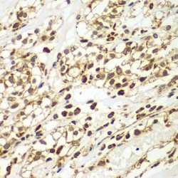 Mothers Against Decapentaplegic Homolog 9 (SMAD9) Antibody