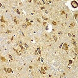 Mothers Against Decapentaplegic Homolog 9 (SMAD9) Antibody