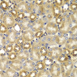 Mothers Against Decapentaplegic Homolog 9 (SMAD9) Antibody