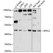 Western blot analysis of extracts of various cell lines using RFPL2 Antibody (1/3000 dilution).