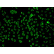 Immunofluorescence analysis of A549 cells using PLCXD2 Antibody