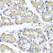 Immunohistochemistry of paraffin-embedded Human stomach using BCS1L Antibody (1/100 dilution, 40x lens).