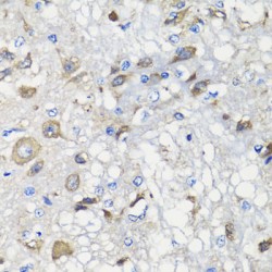 Mitochondrial Chaperone BCS1 (BCS1L) Antibody