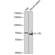 Western blot analysis of extracts of various cell lines using CEL Antibody (1/50 dilution)0.