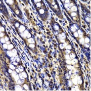 Immunohistochemistry of paraffin-embedded Rat ileum using ARID3A Antibody (1/100 dilution, 40x lens).