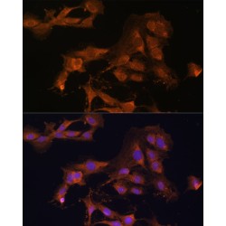 Mitogen-Activated Protein Kinase Kinase 3 (MAP2K3) Antibody