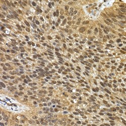 Sequestosome 1 (SQSTM1) Antibody