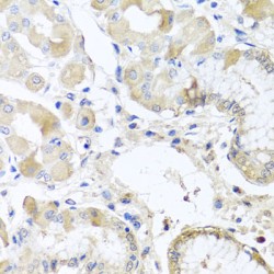Ribosomal Protein L36 (RPL36) Antibody