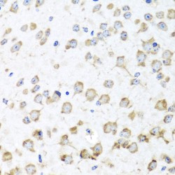 Ribosomal Protein L36 (RPL36) Antibody