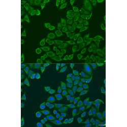 Ribosomal Protein L36 (RPL36) Antibody