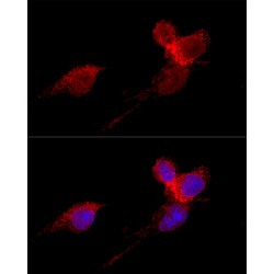 Ribosomal Protein L36 (RPL36) Antibody
