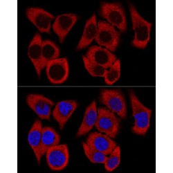 Ribosomal Protein L36 (RPL36) Antibody