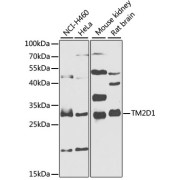 Western blot analysis of extracts of various cell lines using TM2D1 Antibody (1/1000 dilution).