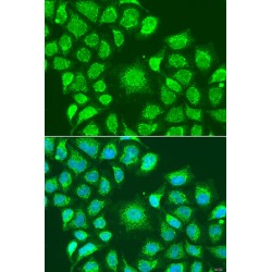 Autophagy Related 4D Cysteine Peptidase (ATG4D) Antibody