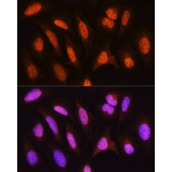Heat Shock-Related 70 kDa Protein 2 (HSPA2) Antibody