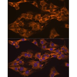 Caprin-1 (CAPRIN1) Antibody