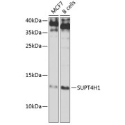 Western blot analysis of extracts of various cell lines using SUPT4H1 Antibody (1/1000 dilution).