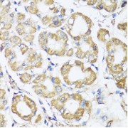 Immunohistochemistry of paraffin-embedded Human stomach using B9D1 Antibody (1/100 dilution, 40x lens).