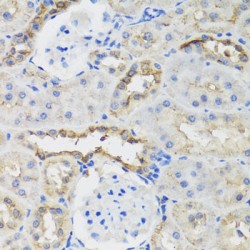 B9 Domain-Containing Protein 1 (B9D1) Antibody